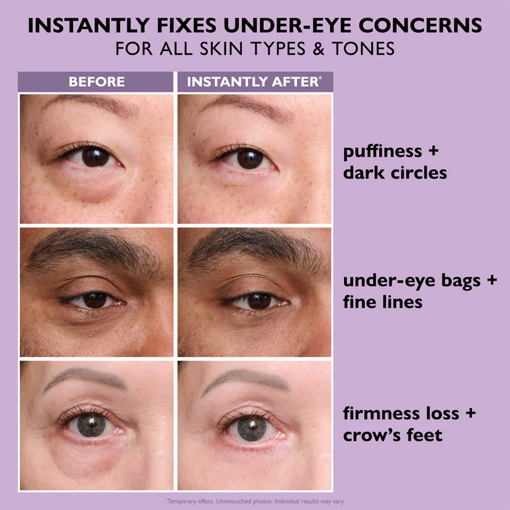 TLC | Instant Eye Tightener