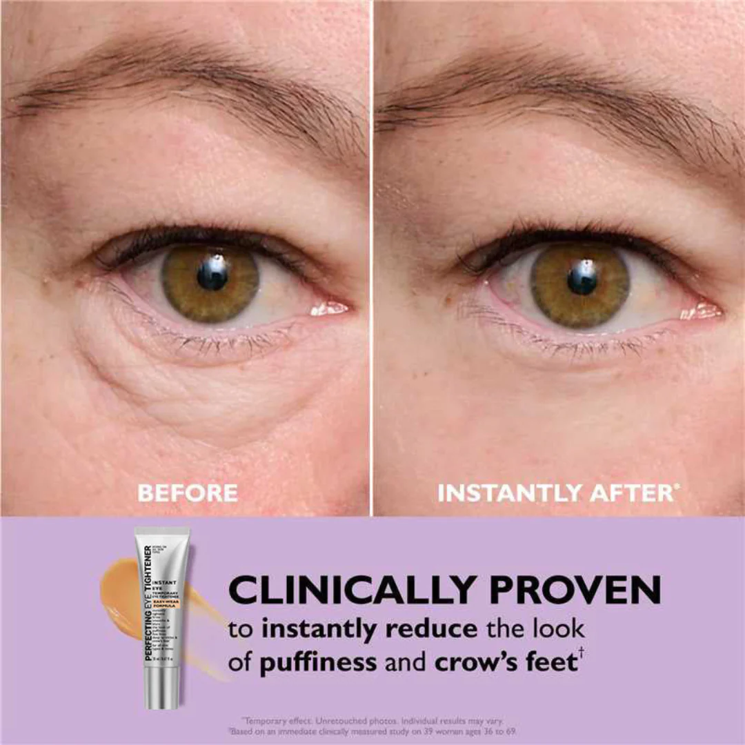 TLC | Instant Eye Tightener